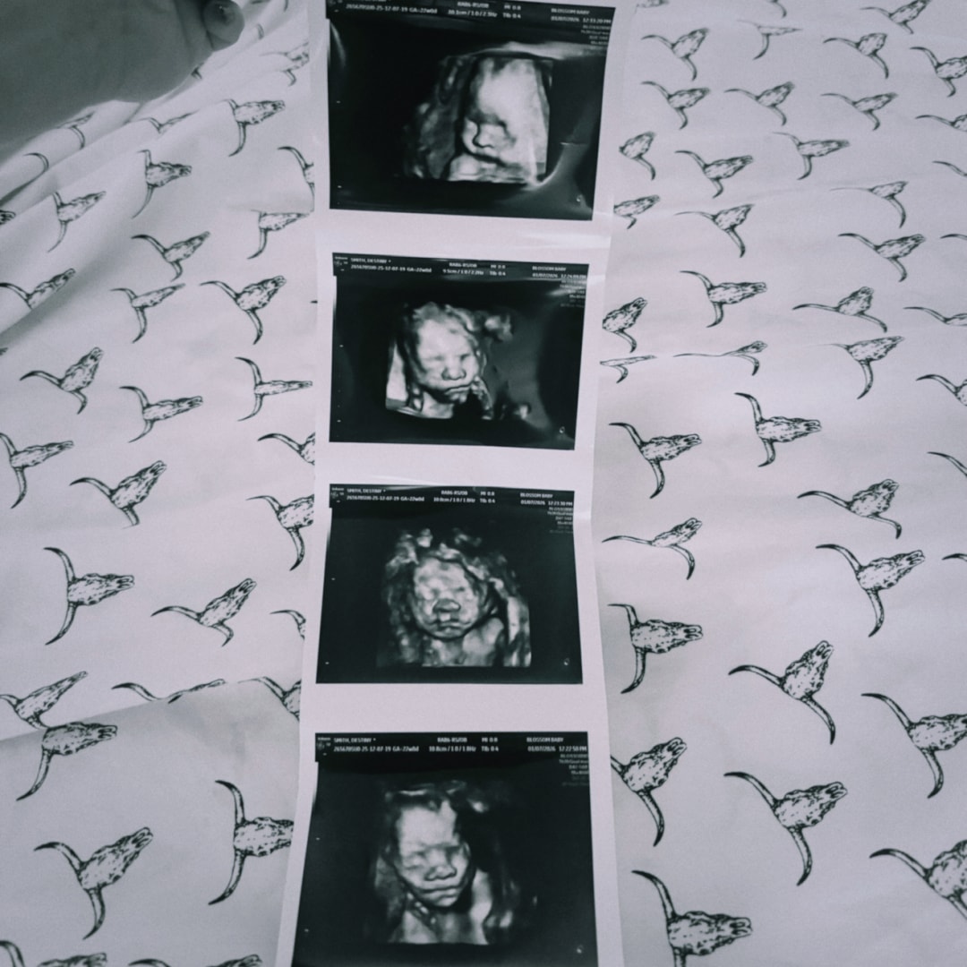 Photo shared by Destiny for their Babylist baby registry.