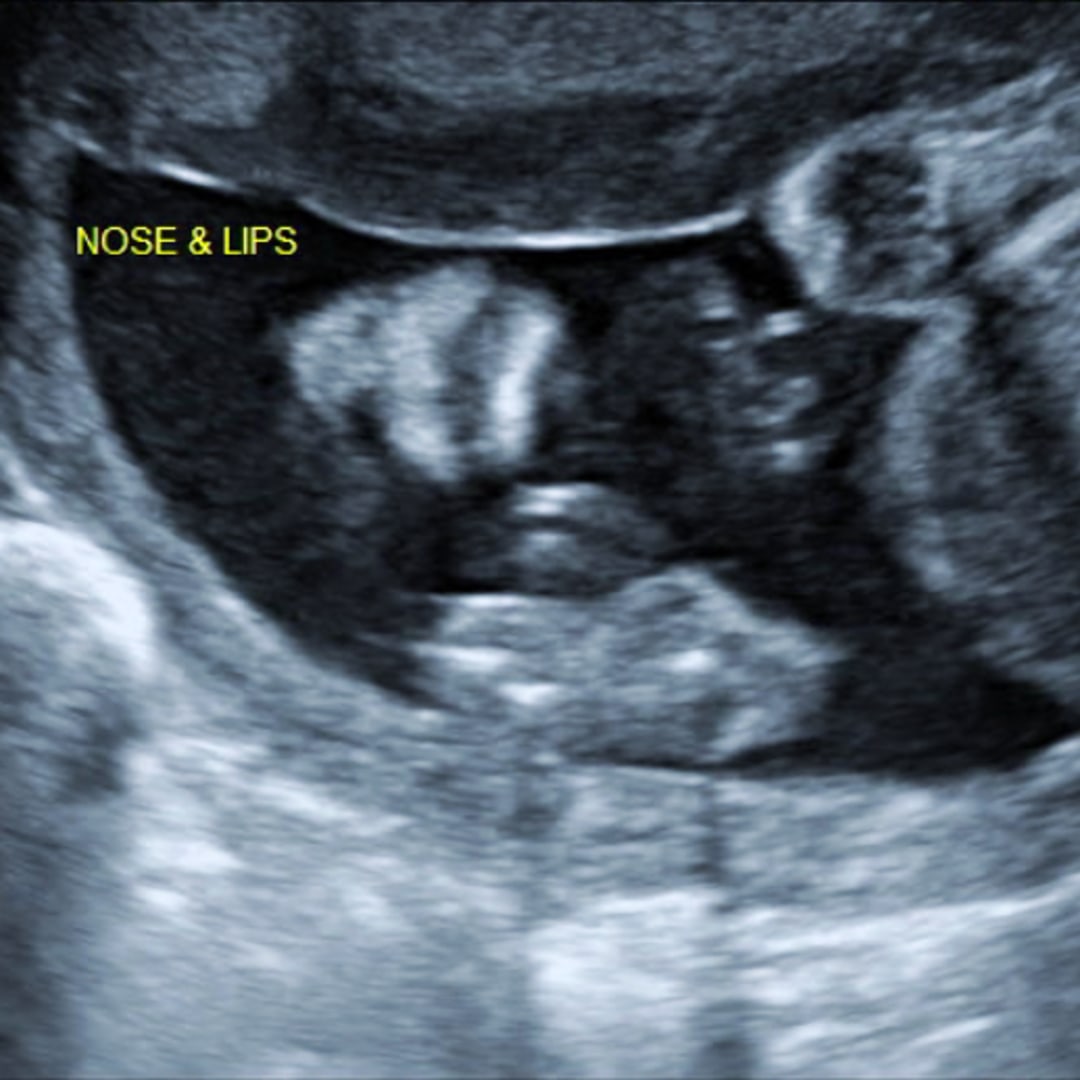 Photo shared by Jacey for their Babylist baby registry.