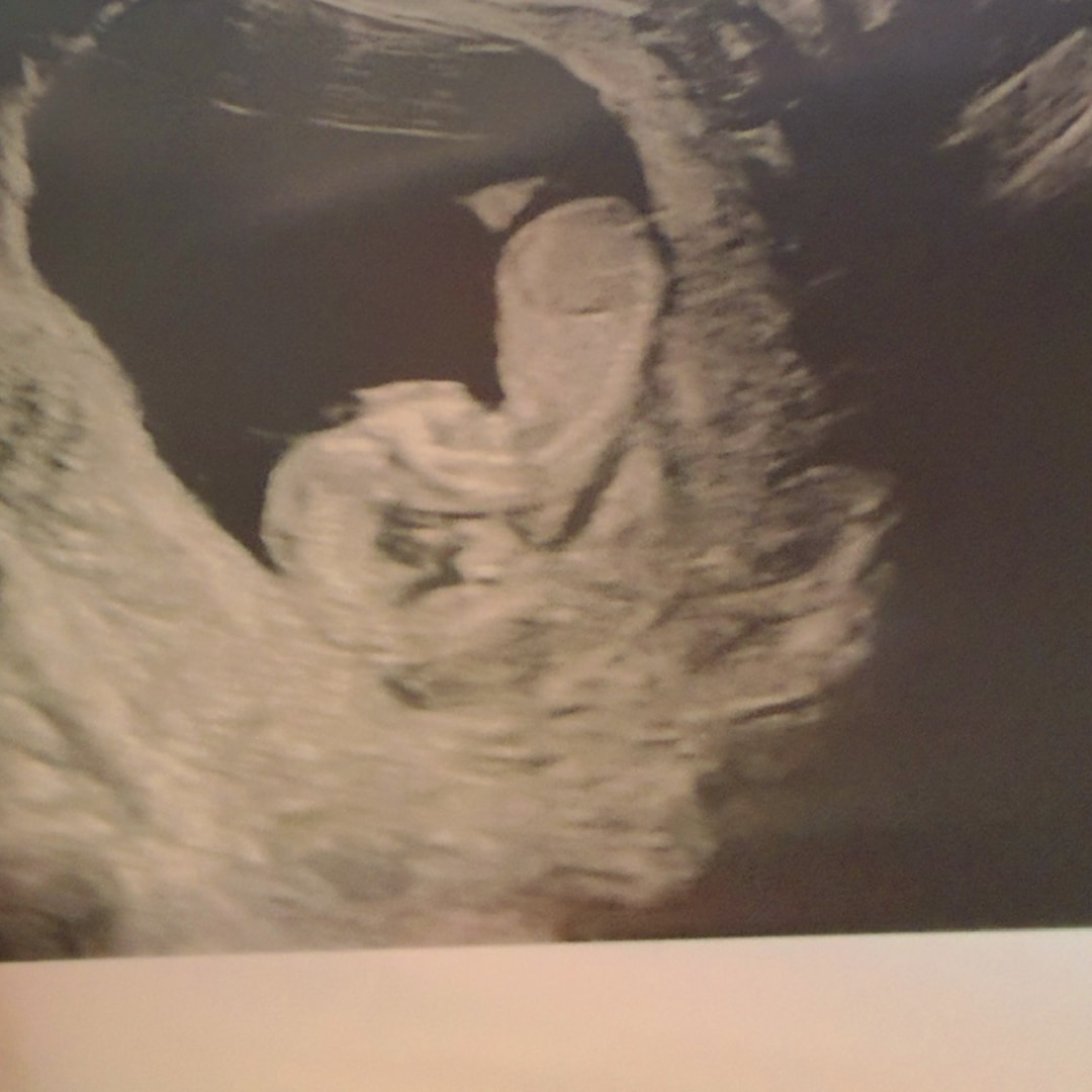 Photo shared by Elizabeth for their Babylist baby registry.