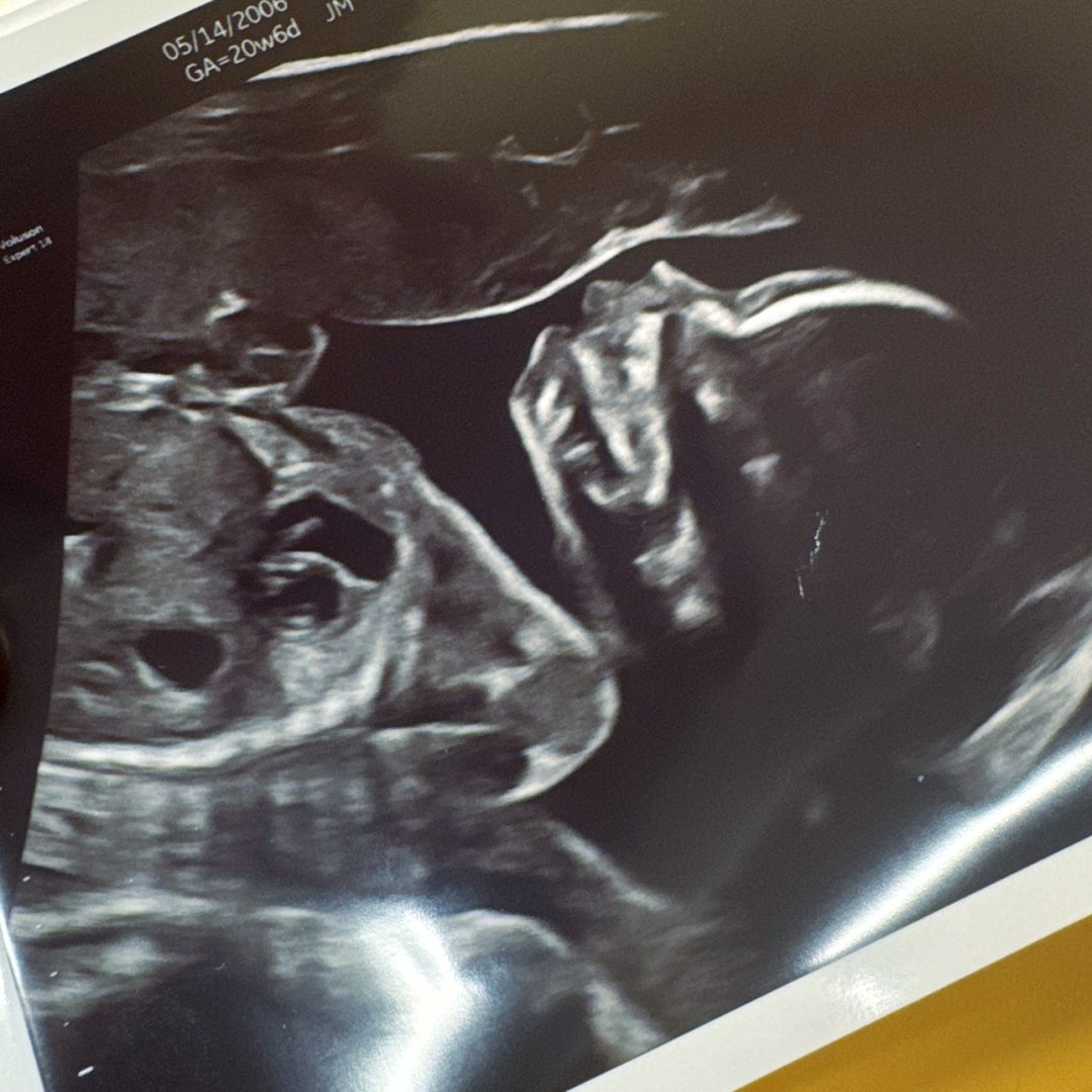 Photo shared by Bryanna for their Babylist baby registry.