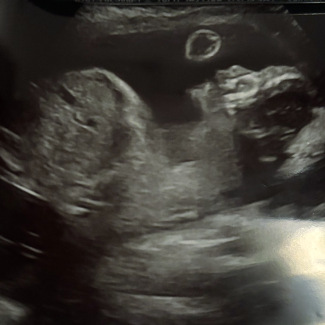 Photo shared by Peyton for their Babylist baby registry.