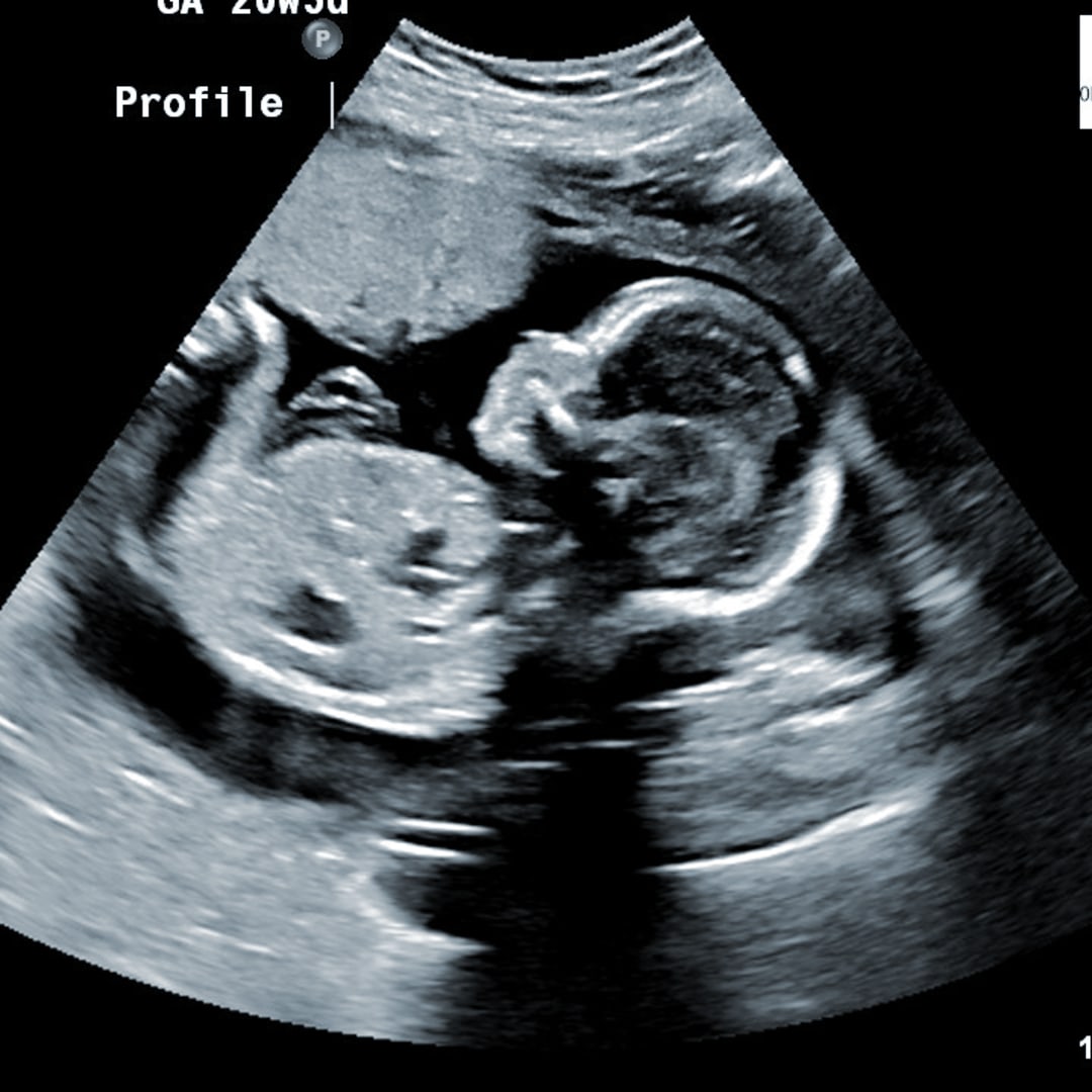 Photo shared by Sarah for their Babylist baby registry.