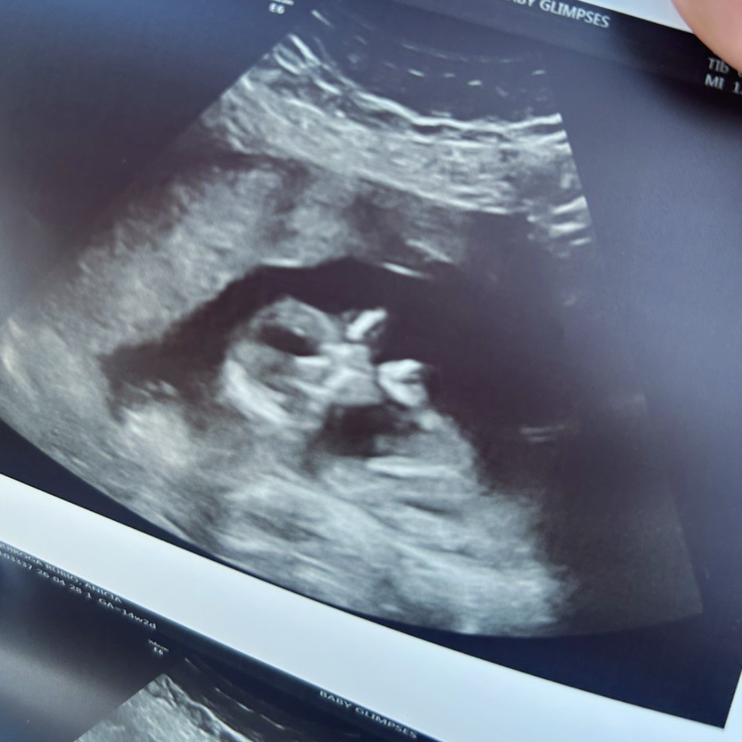 Photo shared by Anicia for their Babylist baby registry.