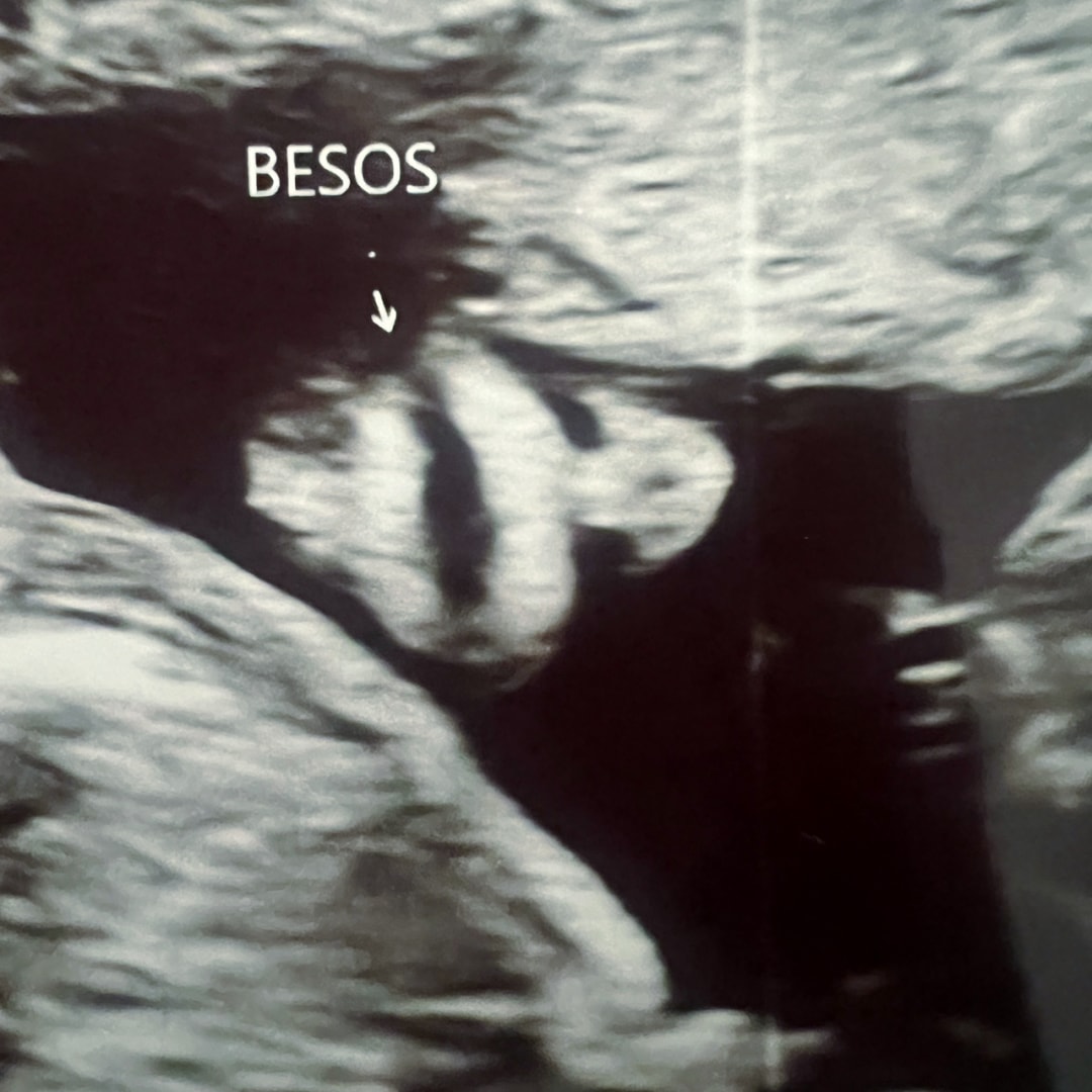 Photo shared by Fern for their Babylist baby registry.