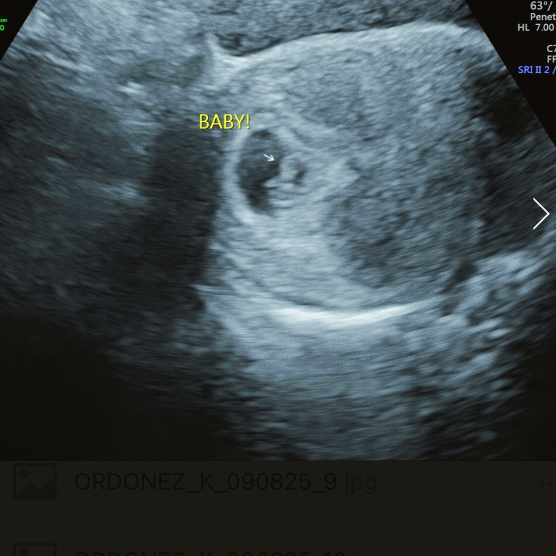 Photo shared by Athena for their Babylist baby registry.