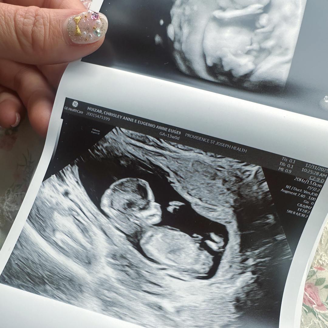 Photo shared by Chrisley Anne for their Babylist baby registry.