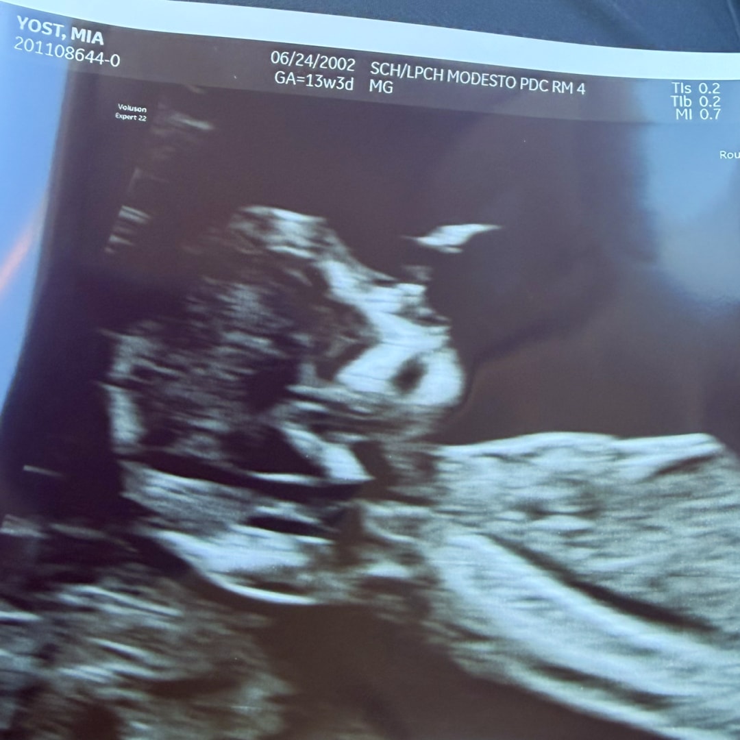 Photo shared by Mia for their Babylist baby registry.