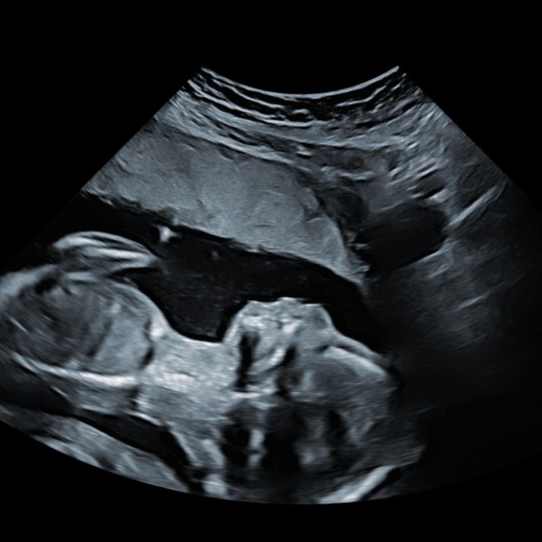 Photo shared by Allie for their Babylist baby registry.