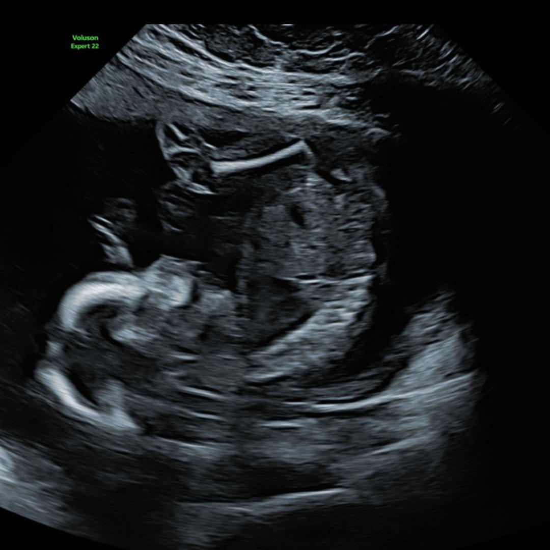 Photo shared by Vanessa for their Babylist baby registry.