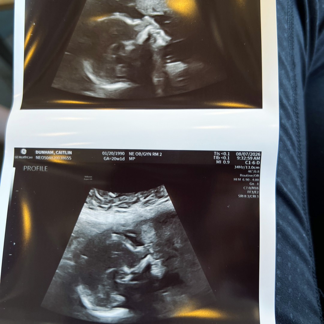 Photo shared by Caitlin for their Babylist baby registry.