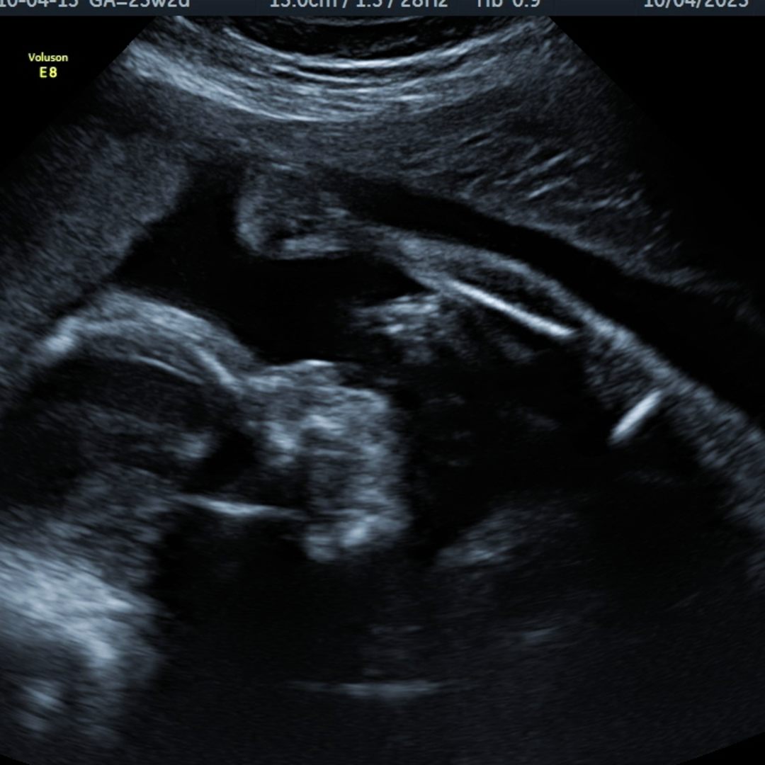 Photo shared by Laura for their Babylist baby registry.