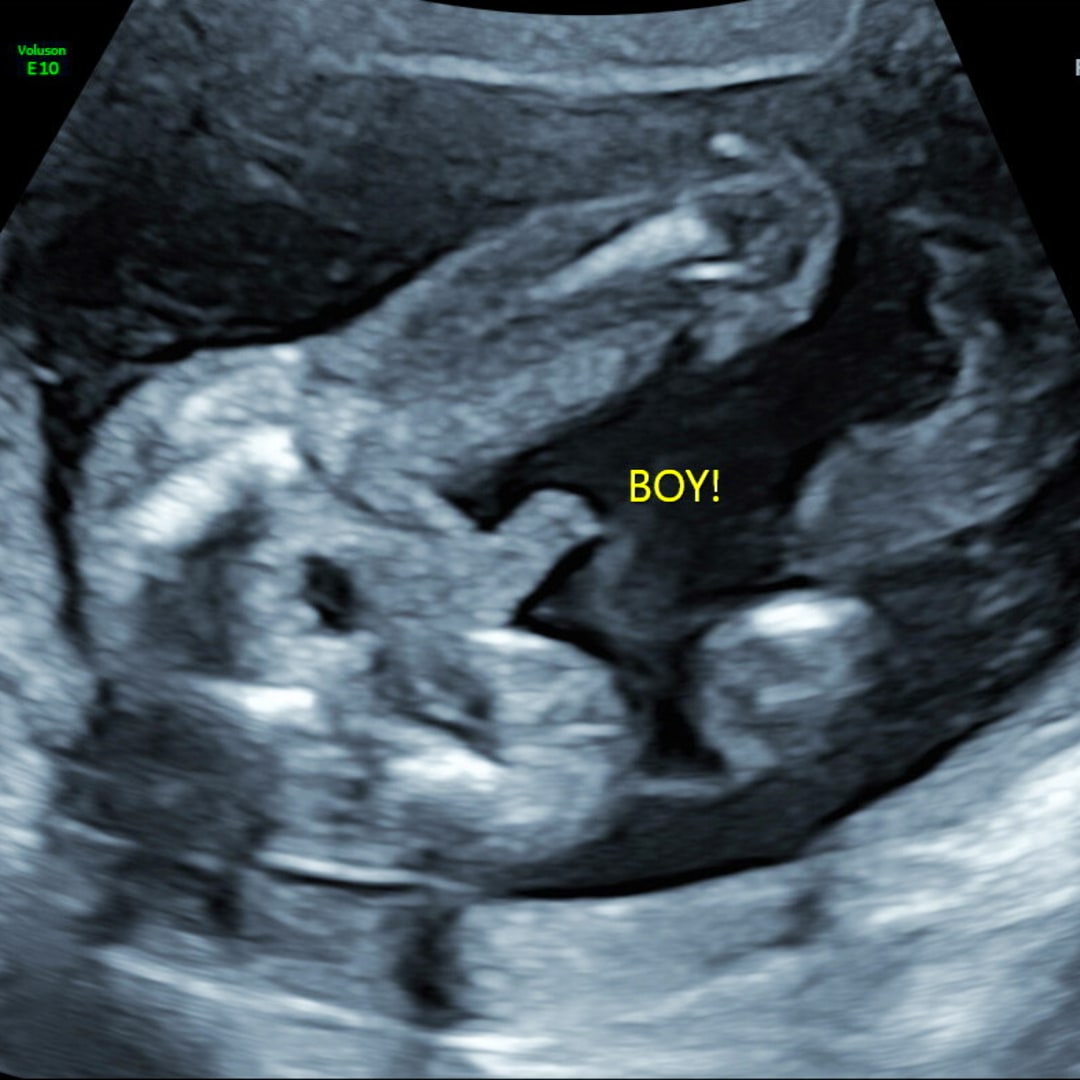 Photo shared by Courtney for their Babylist baby registry.