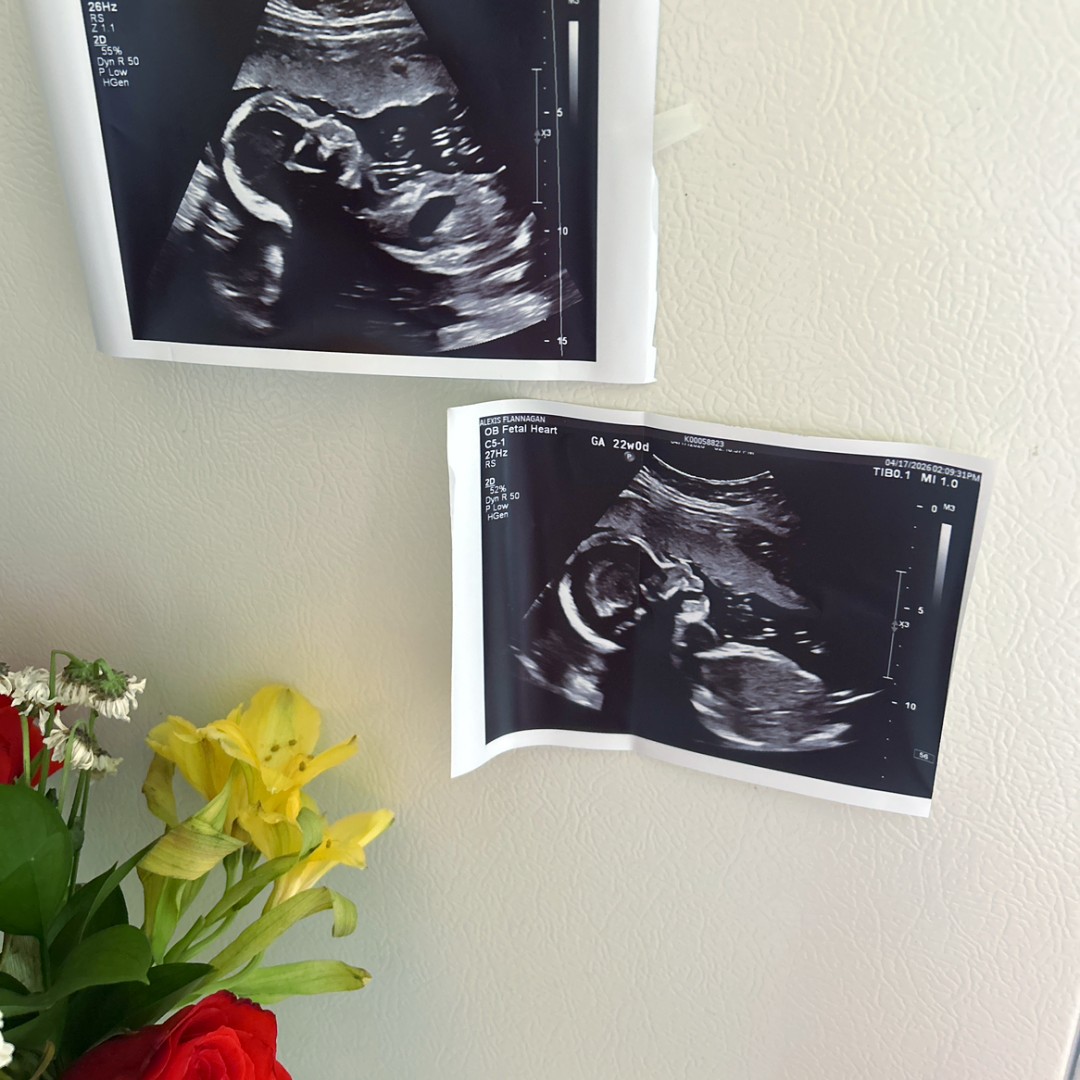 Photo shared by Alexis for their Babylist baby registry.