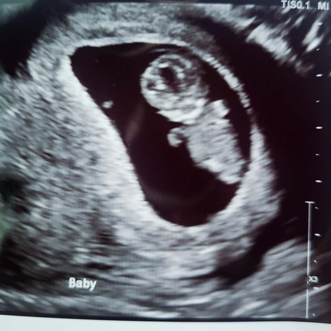 Photo shared by Christina for their Babylist baby registry.