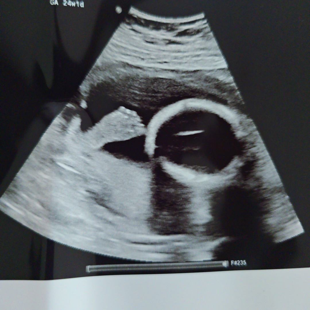 Photo shared by Sara for their Babylist baby registry.