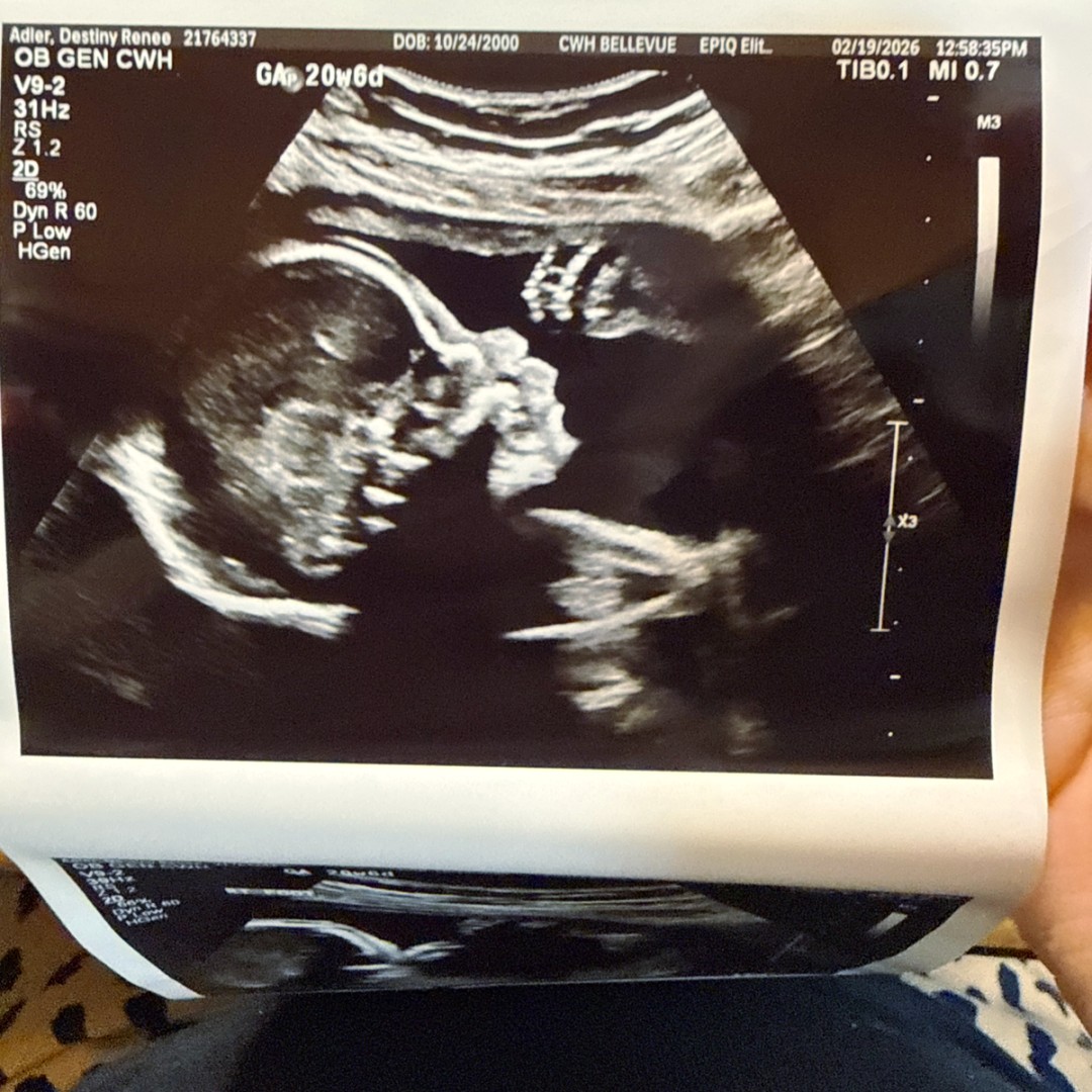 Photo shared by Destiny for their Babylist baby registry.