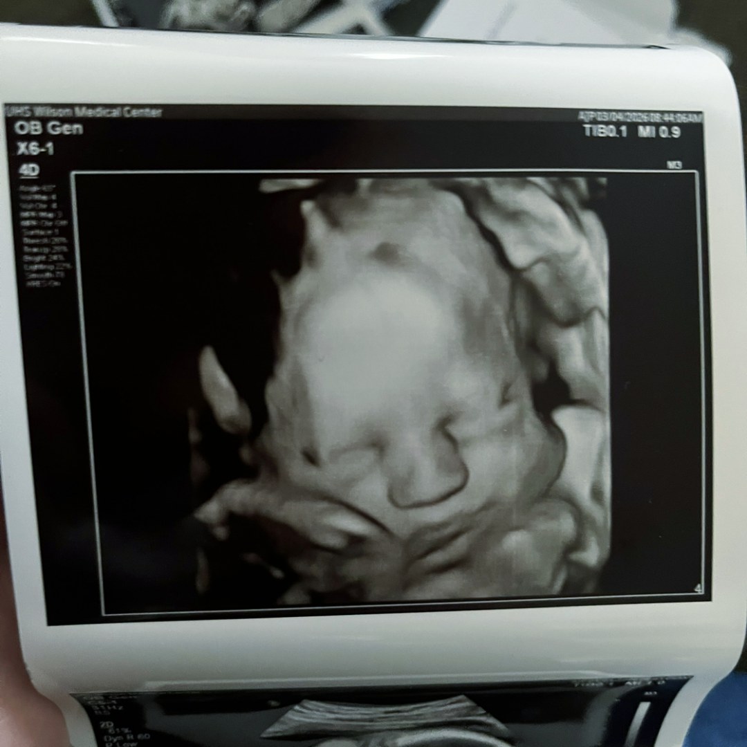 Photo shared by Emily for their Babylist baby registry.