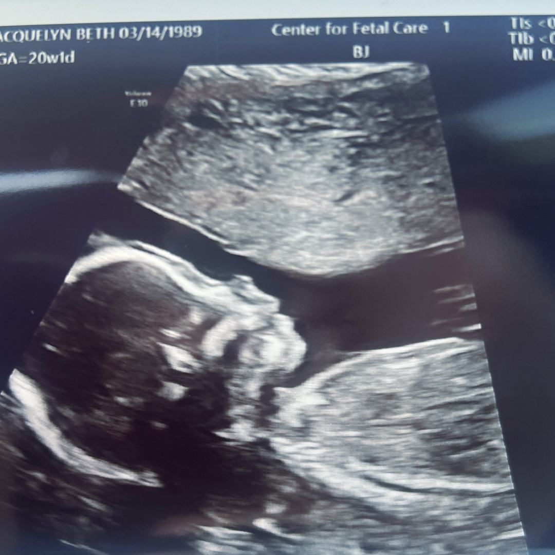 Photo shared by Jennie for their Babylist baby registry.