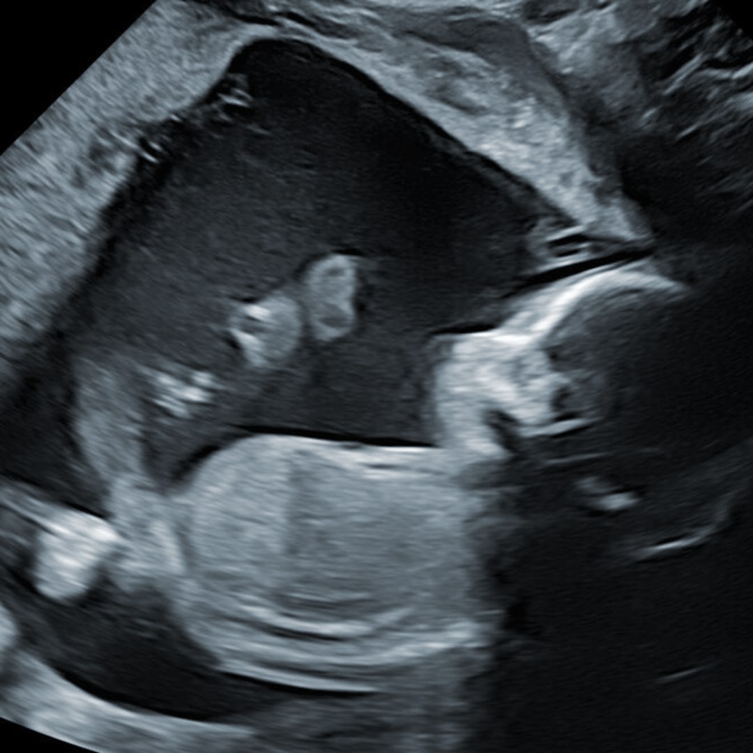 Photo shared by Arianna for their Babylist baby registry.