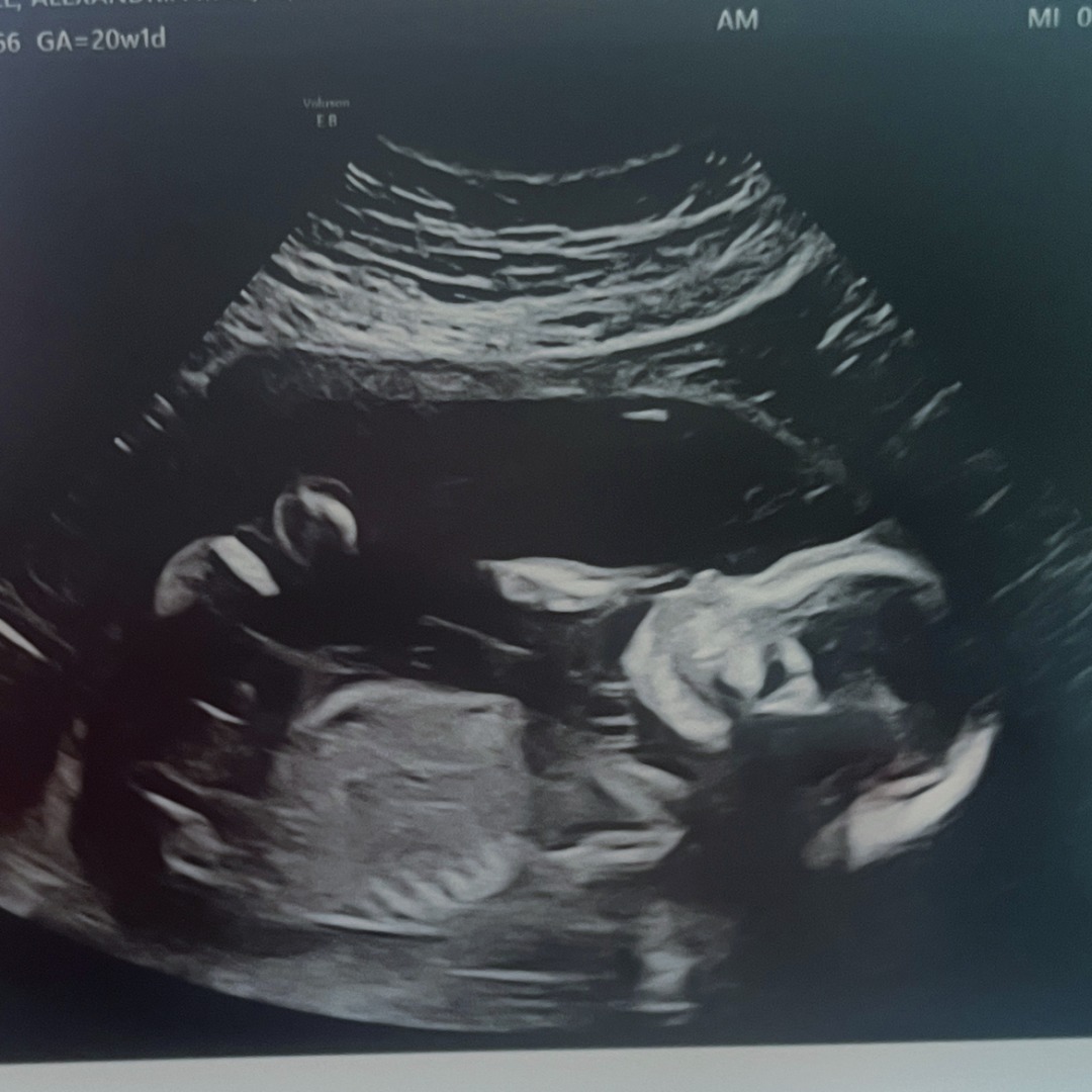 Photo shared by Allie for their Babylist baby registry.