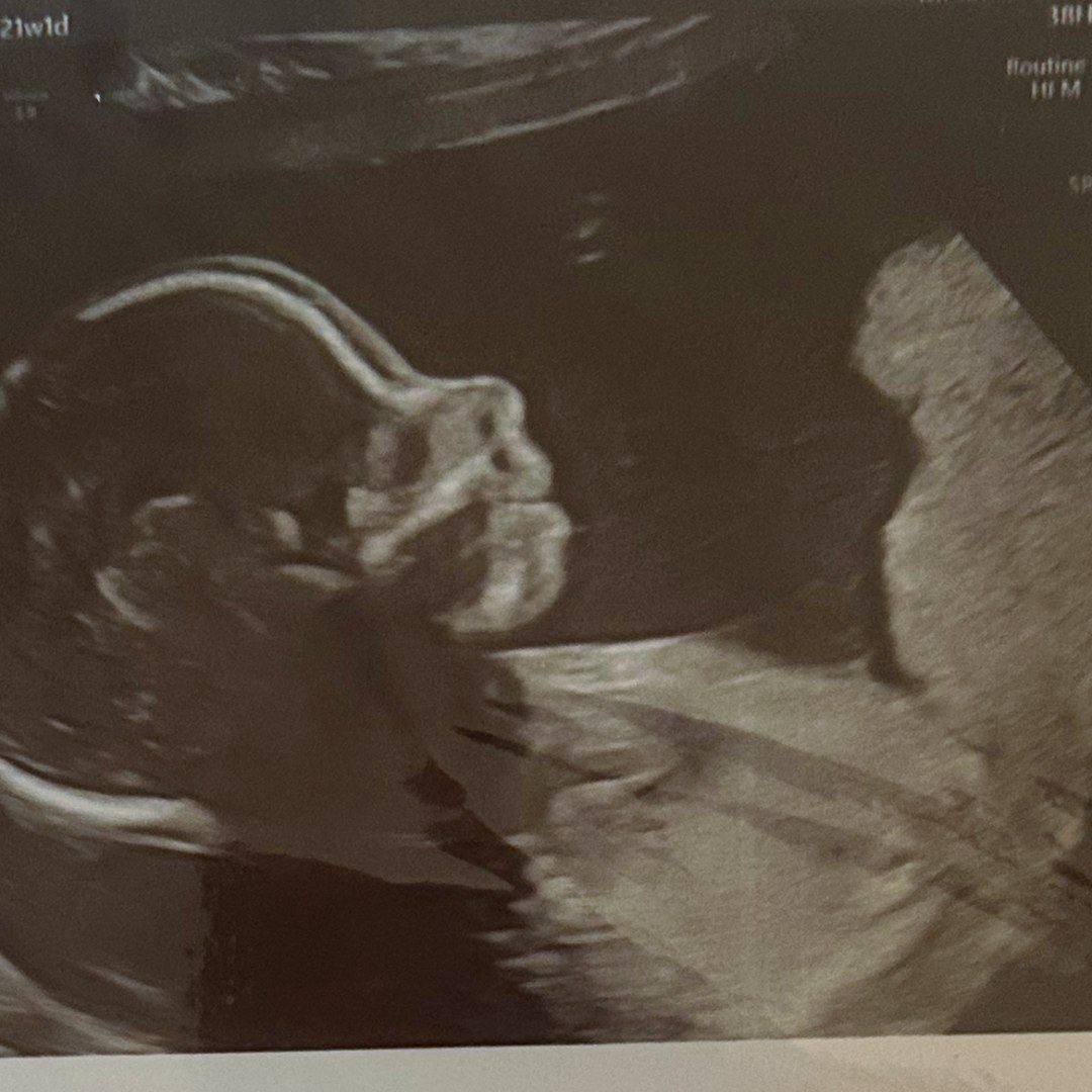 Photo shared by Akire for their Babylist baby registry.