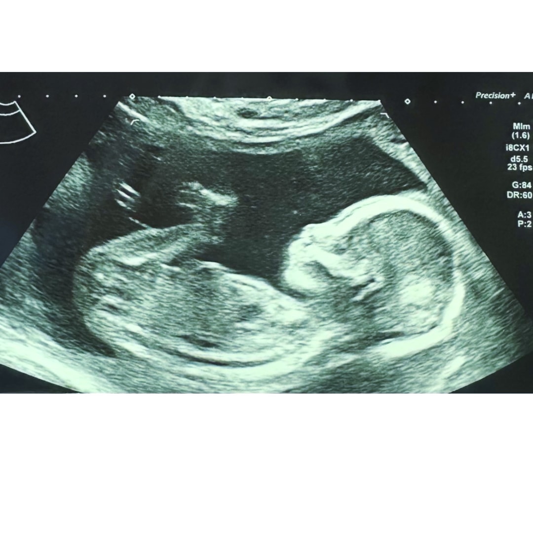 Photo shared by Fabiana for their Babylist baby registry.