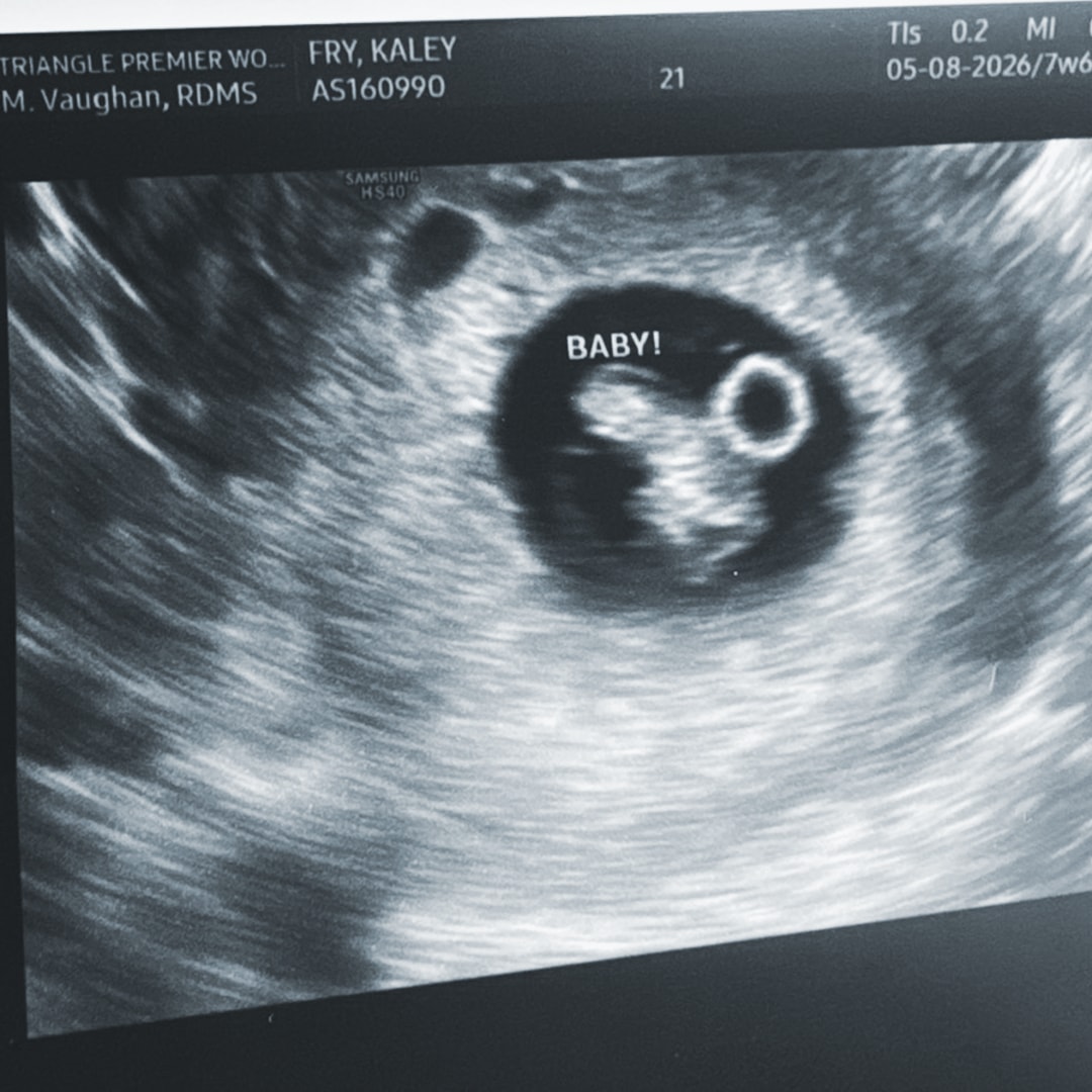 Photo shared by Kaley for their Babylist baby registry.