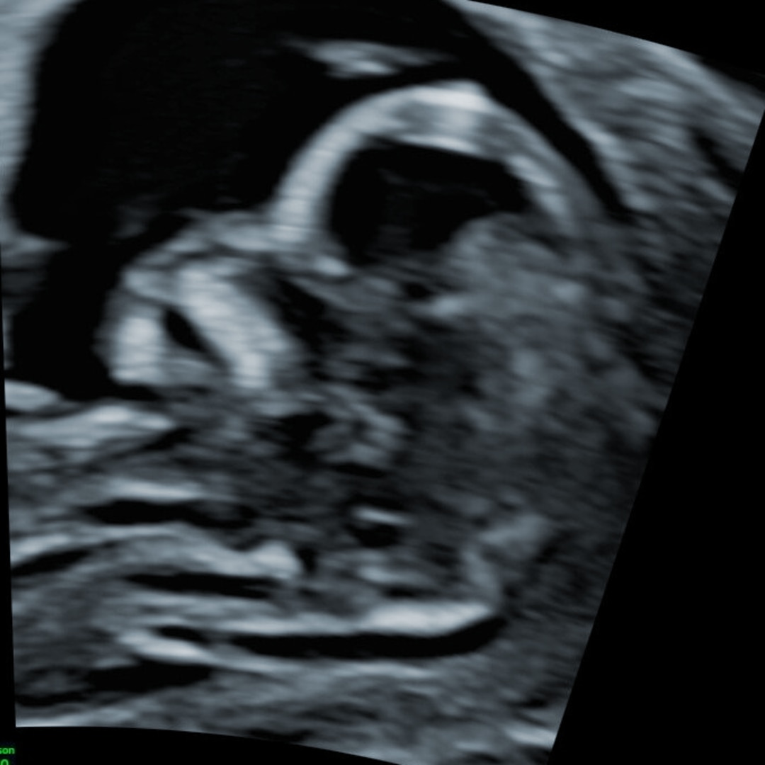 Photo shared by Dakota Star for their Babylist baby registry.