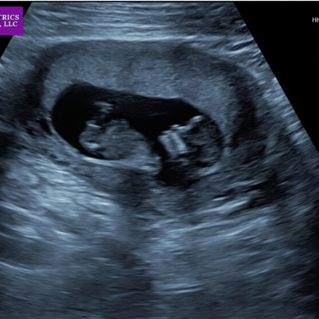 Photo shared by Jessica for their Babylist baby registry.