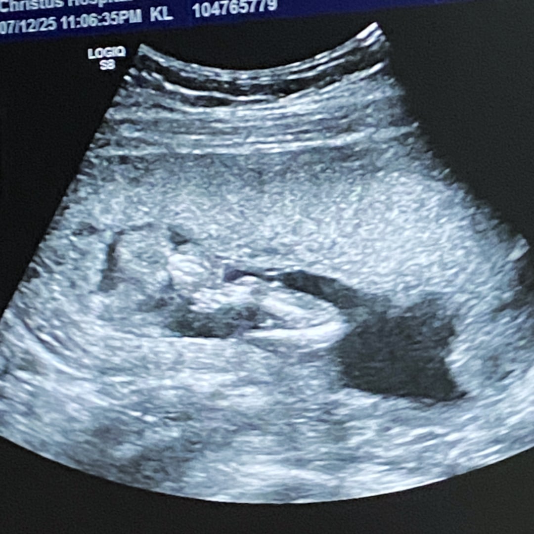 Photo shared by Brynllie for their Babylist baby registry.
