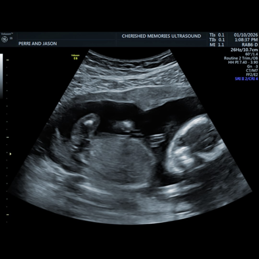 Photo shared by Perri for their Babylist baby registry.
