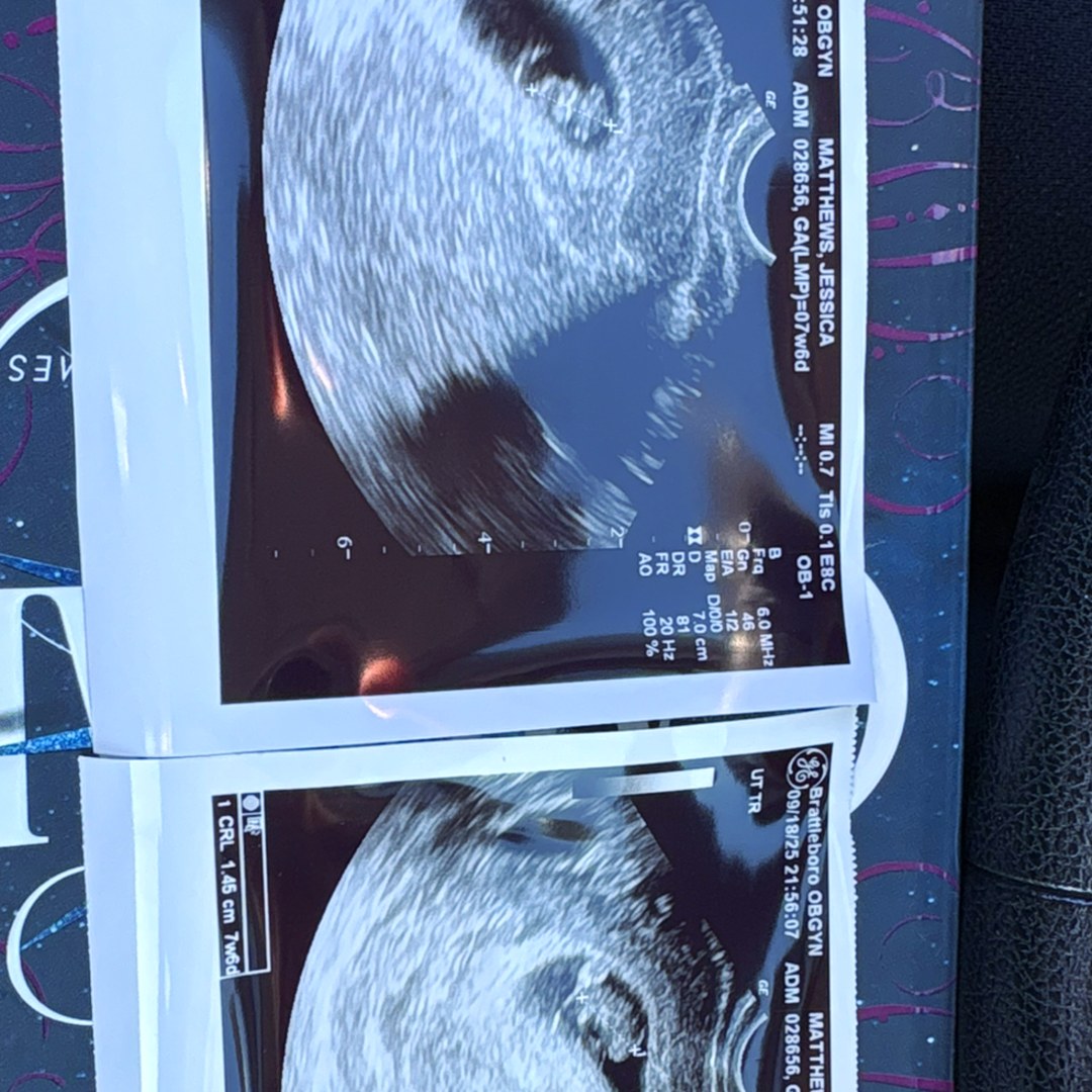 Photo shared by Jessica for their Babylist baby registry.