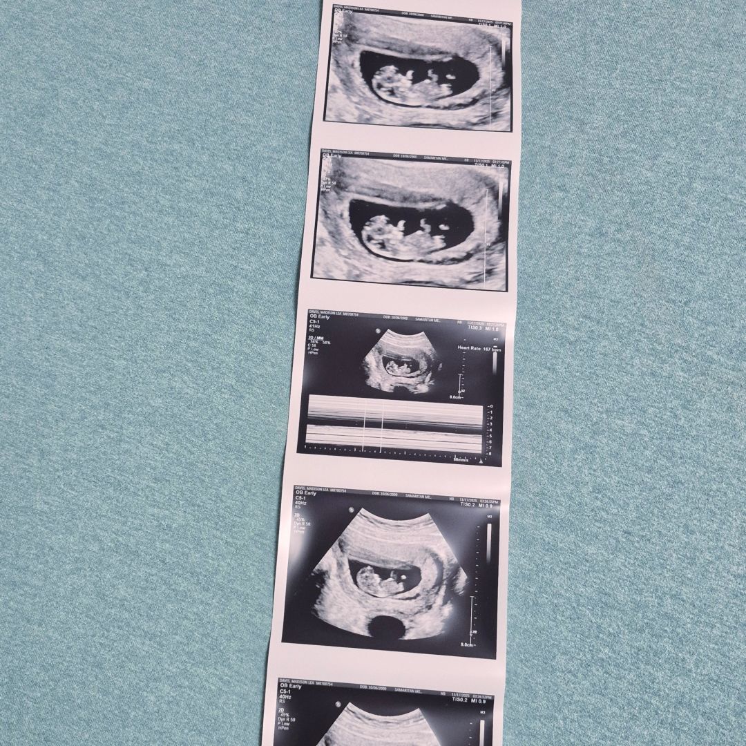 Photo shared by Madison for their Babylist baby registry.