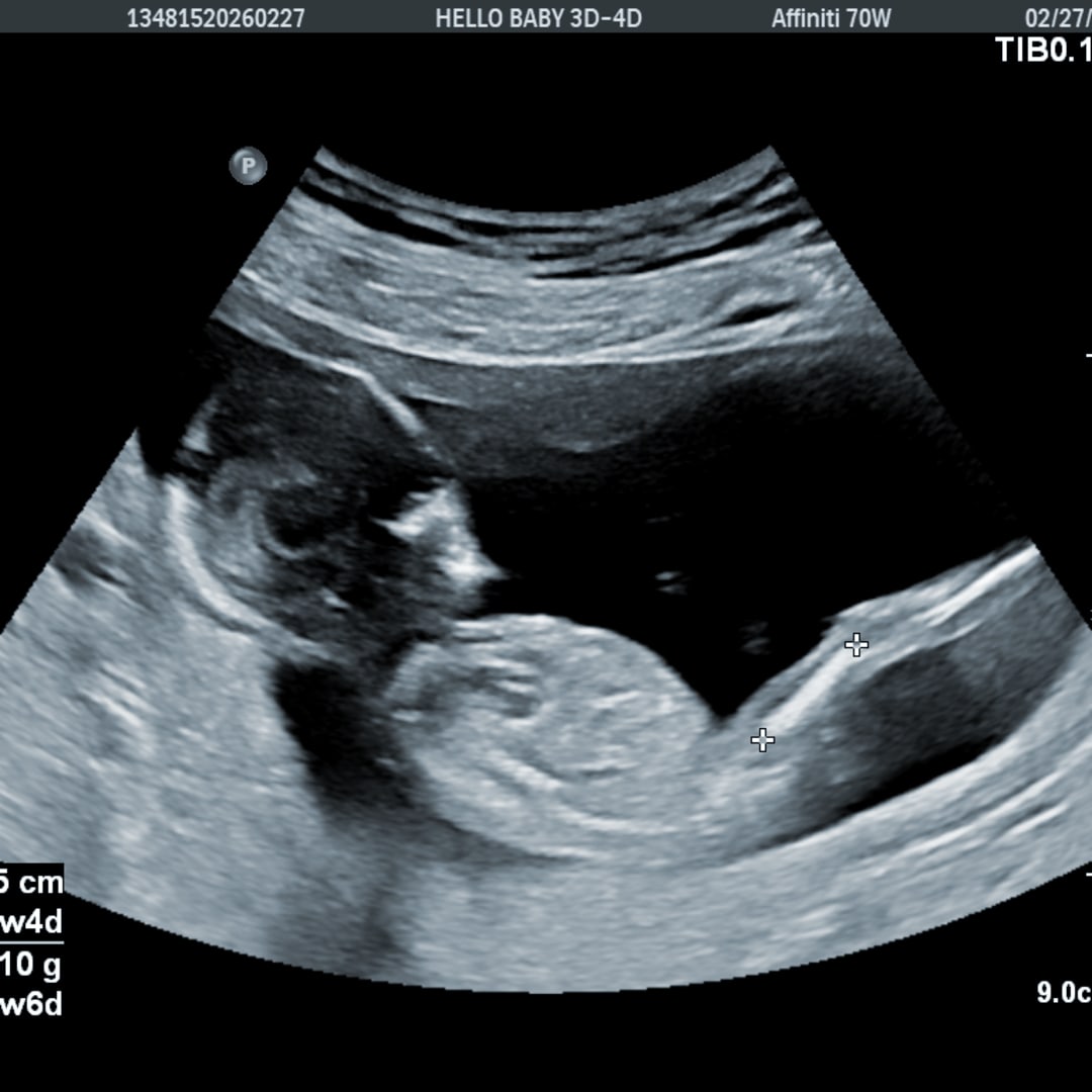 Photo shared by Tabitha for their Babylist baby registry.