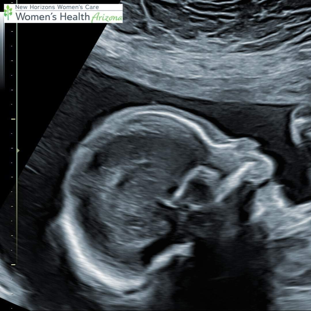 Photo shared by Eliza for their Babylist baby registry.