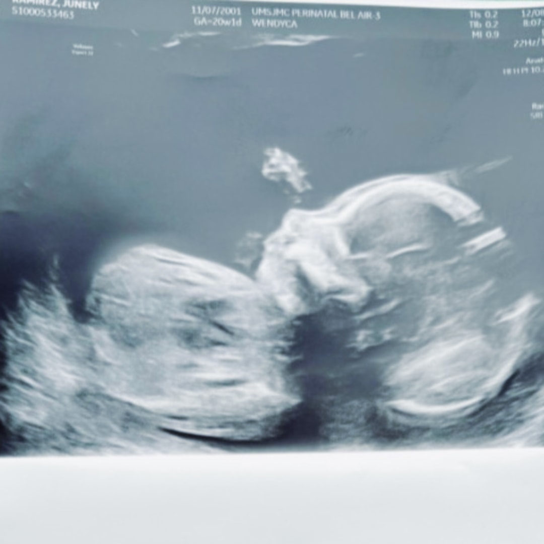 Photo shared by July for their Babylist baby registry.