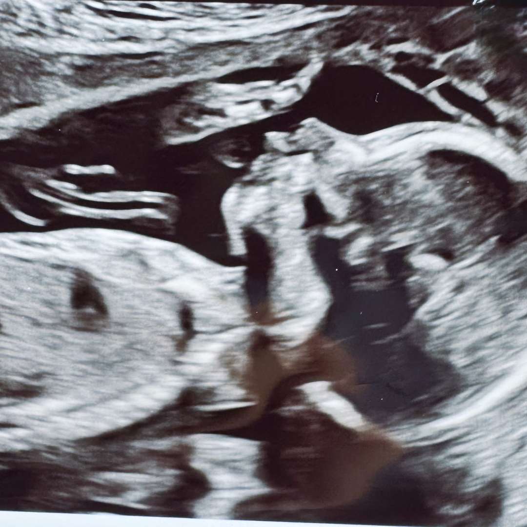 Photo shared by Coco for their Babylist baby registry.