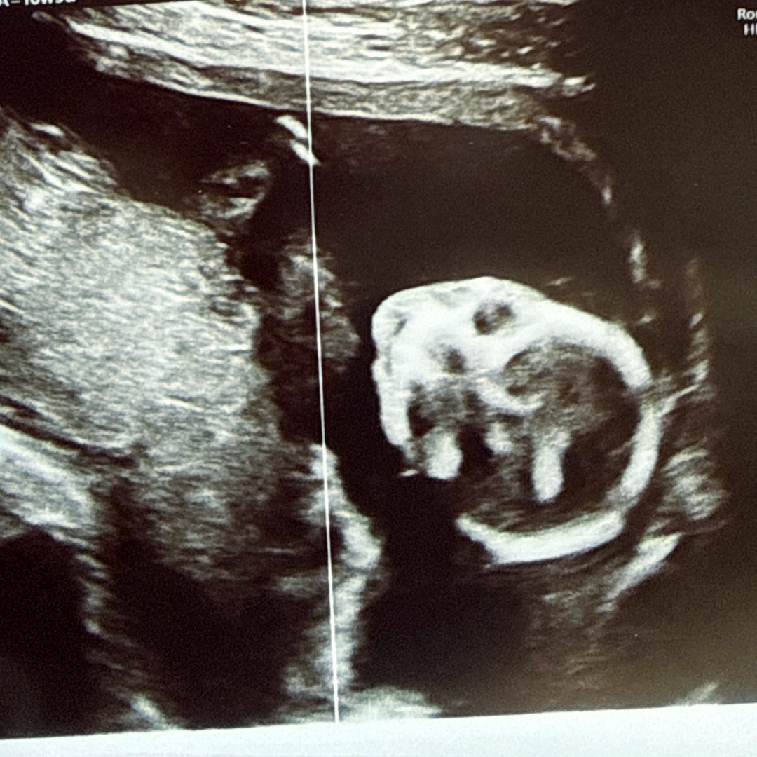 Photo shared by Nena for their Babylist baby registry.