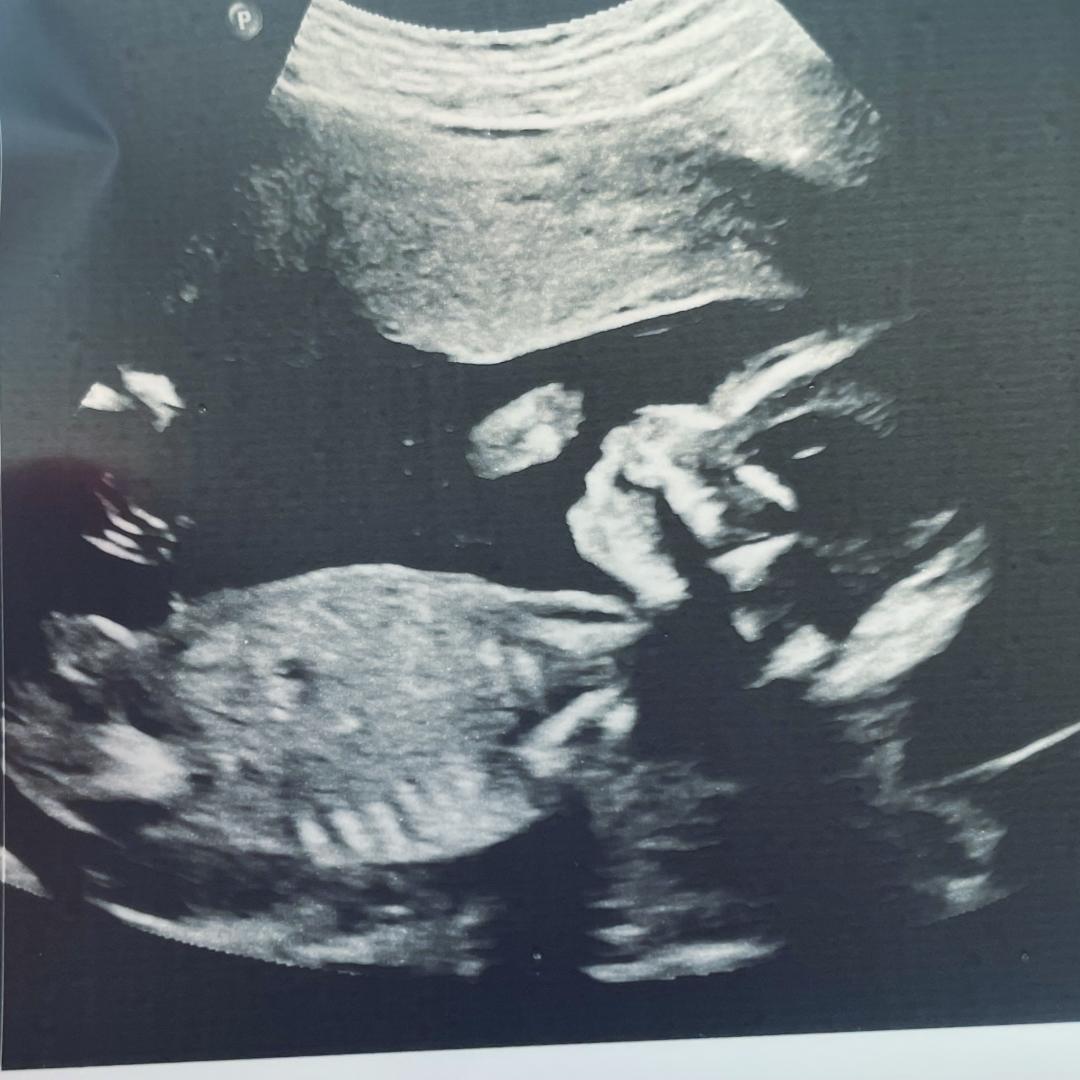 Photo shared by Shawnee for their Babylist baby registry.