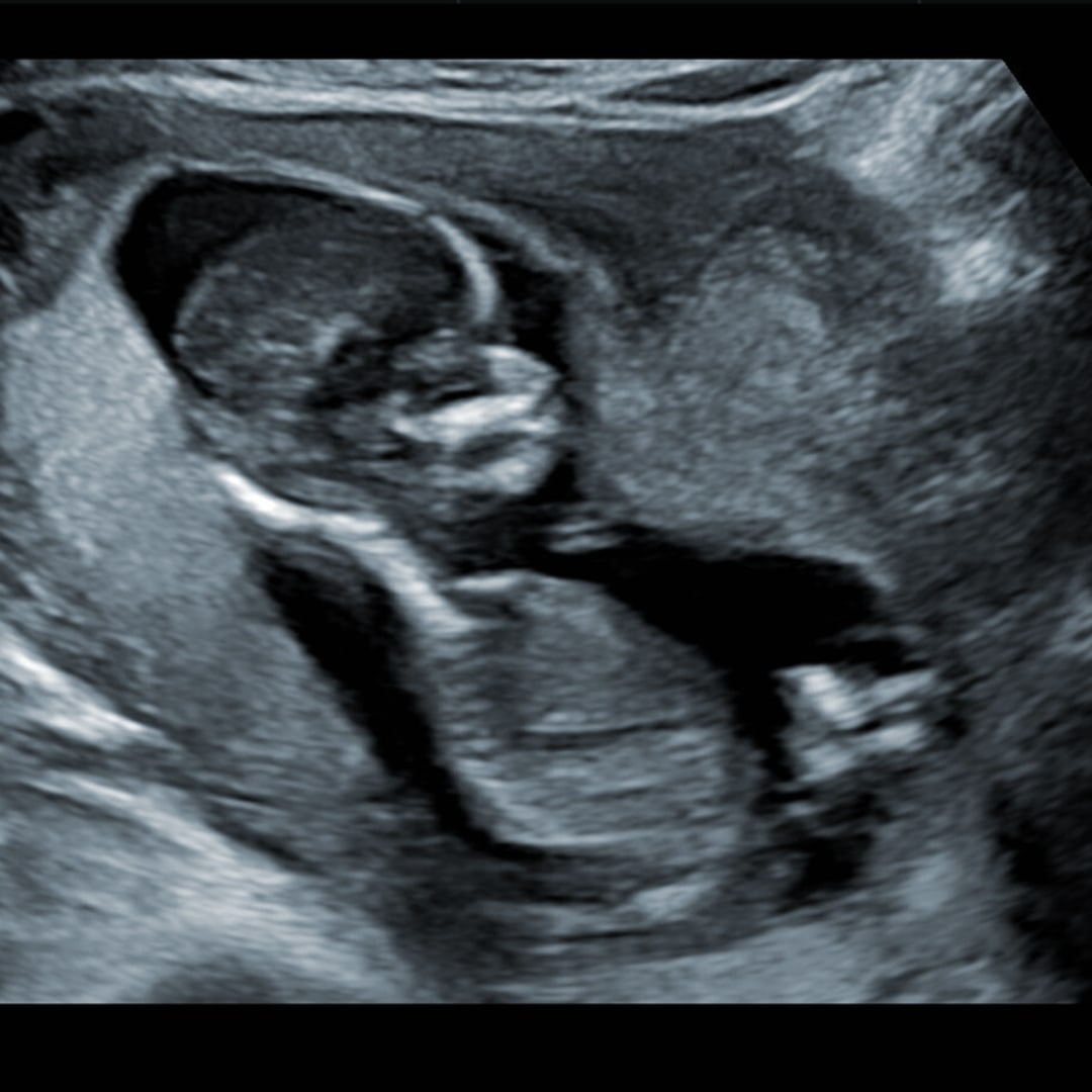 Photo shared by Andi for their Babylist baby registry.