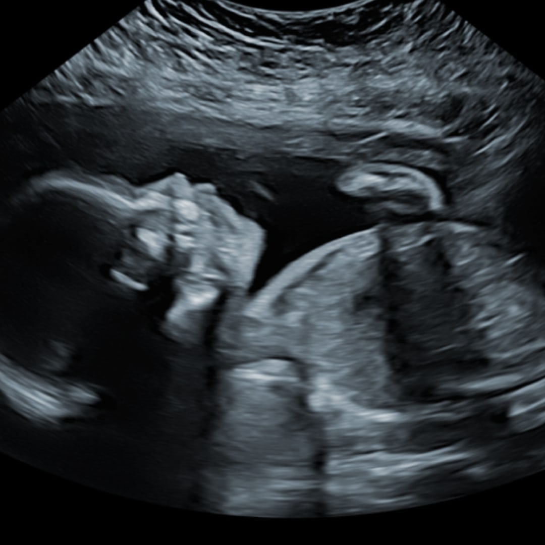 Photo shared by Isabelle for their Babylist baby registry.