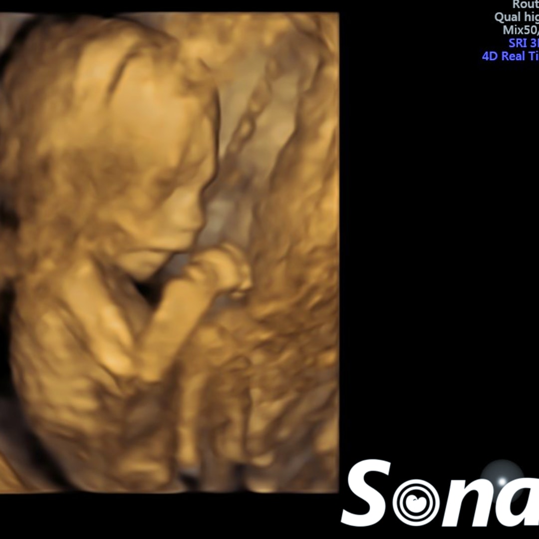 Photo shared by Amy for their Babylist baby registry.