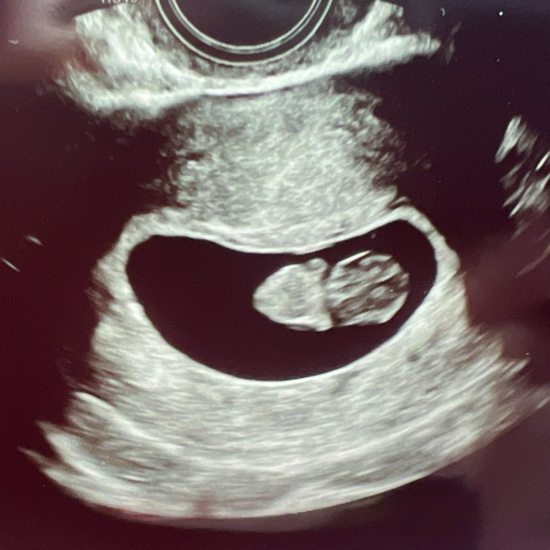 Photo shared by Danielle for their Babylist baby registry.