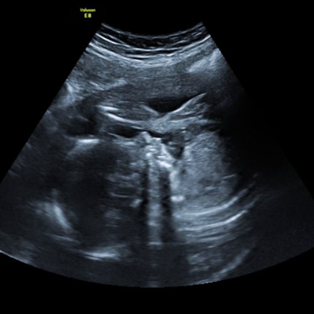 Photo shared by Jacey for their Babylist baby registry.