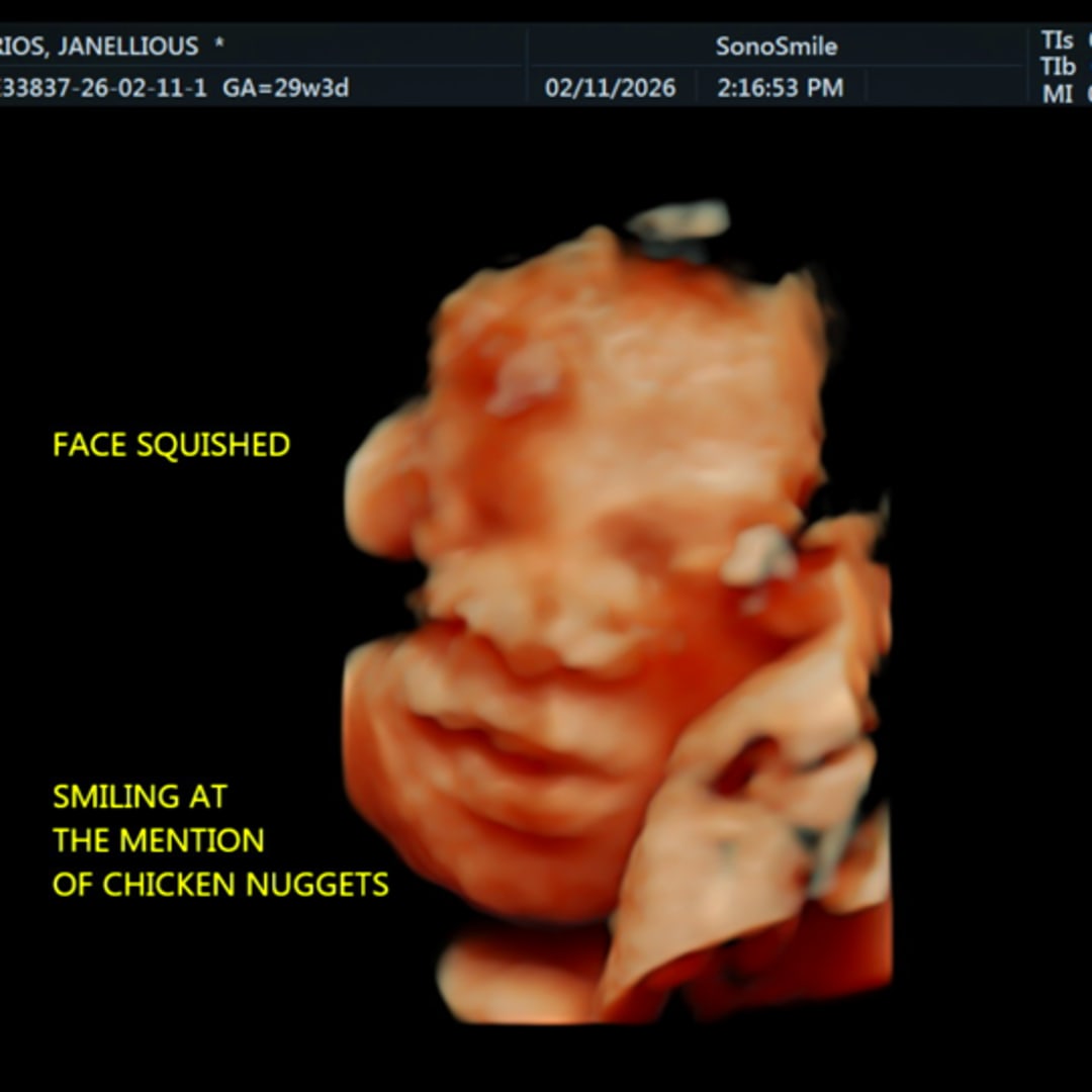 Photo shared by Janellious for their Babylist baby registry.