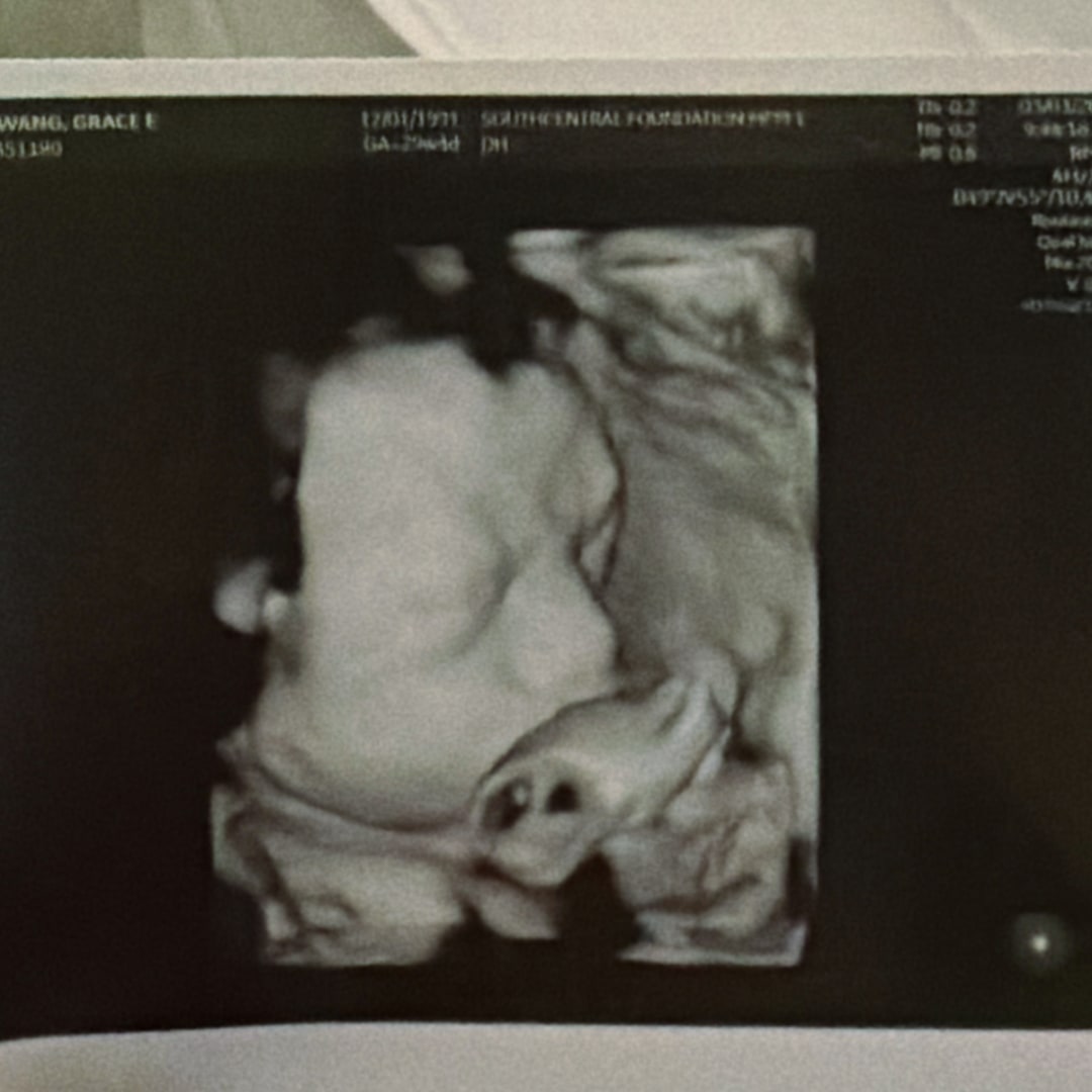 Photo shared by Grace for their Babylist baby registry.