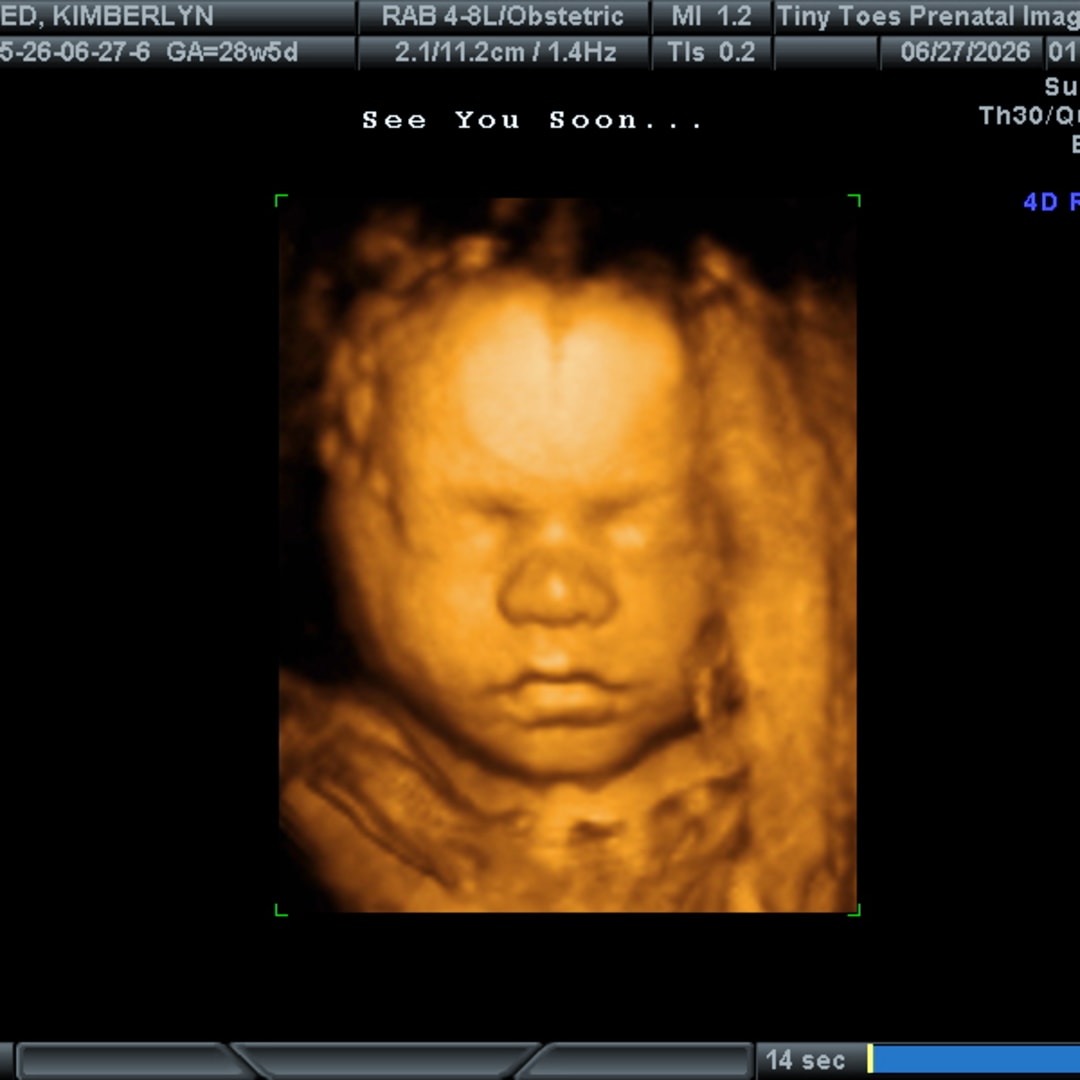 Photo shared by Kimberlyn Creed for their Babylist baby registry.