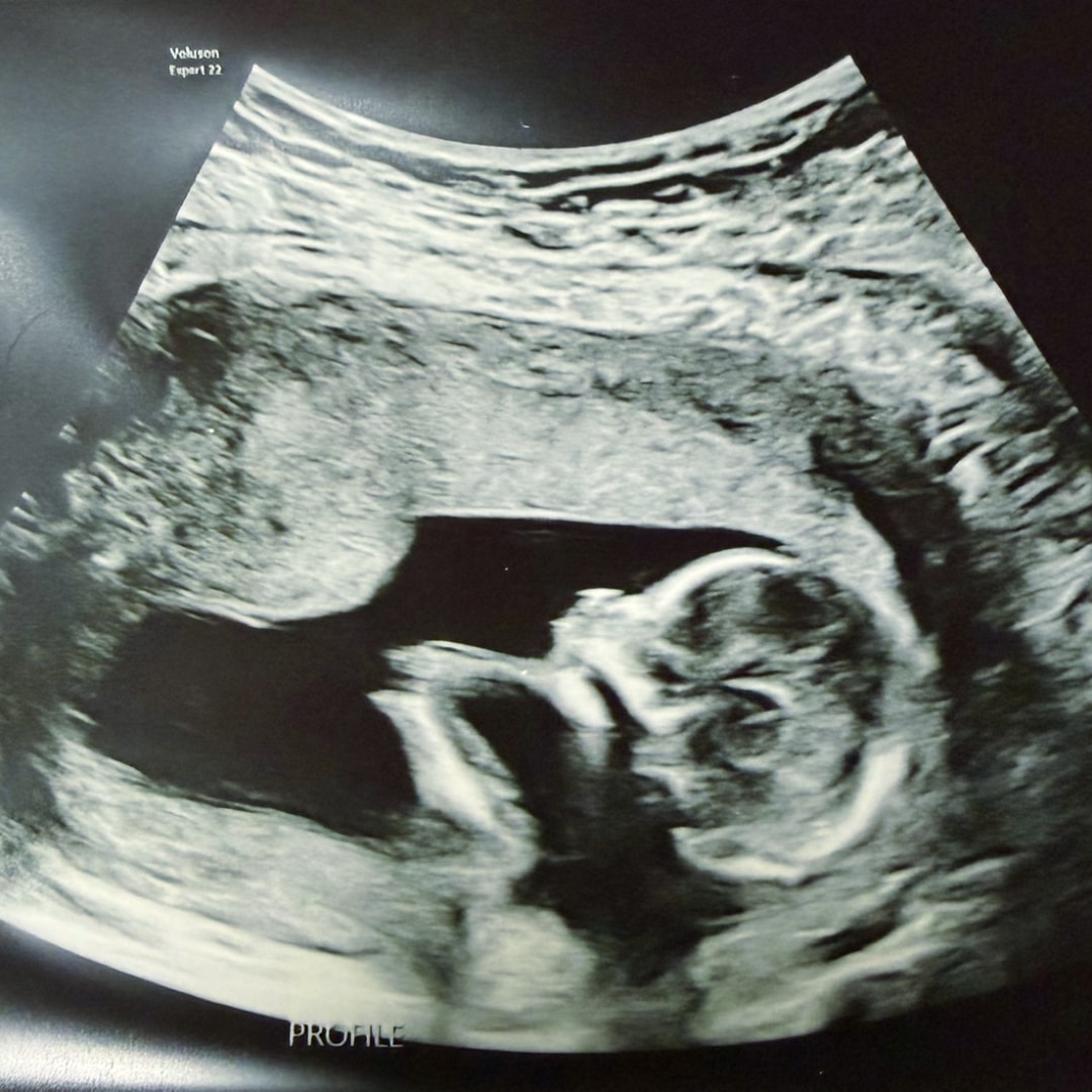 Photo shared by Jessica for their Babylist baby registry.