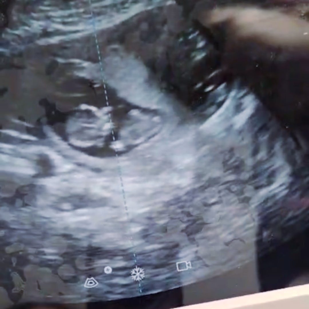 Photo shared by Anita for their Babylist baby registry.