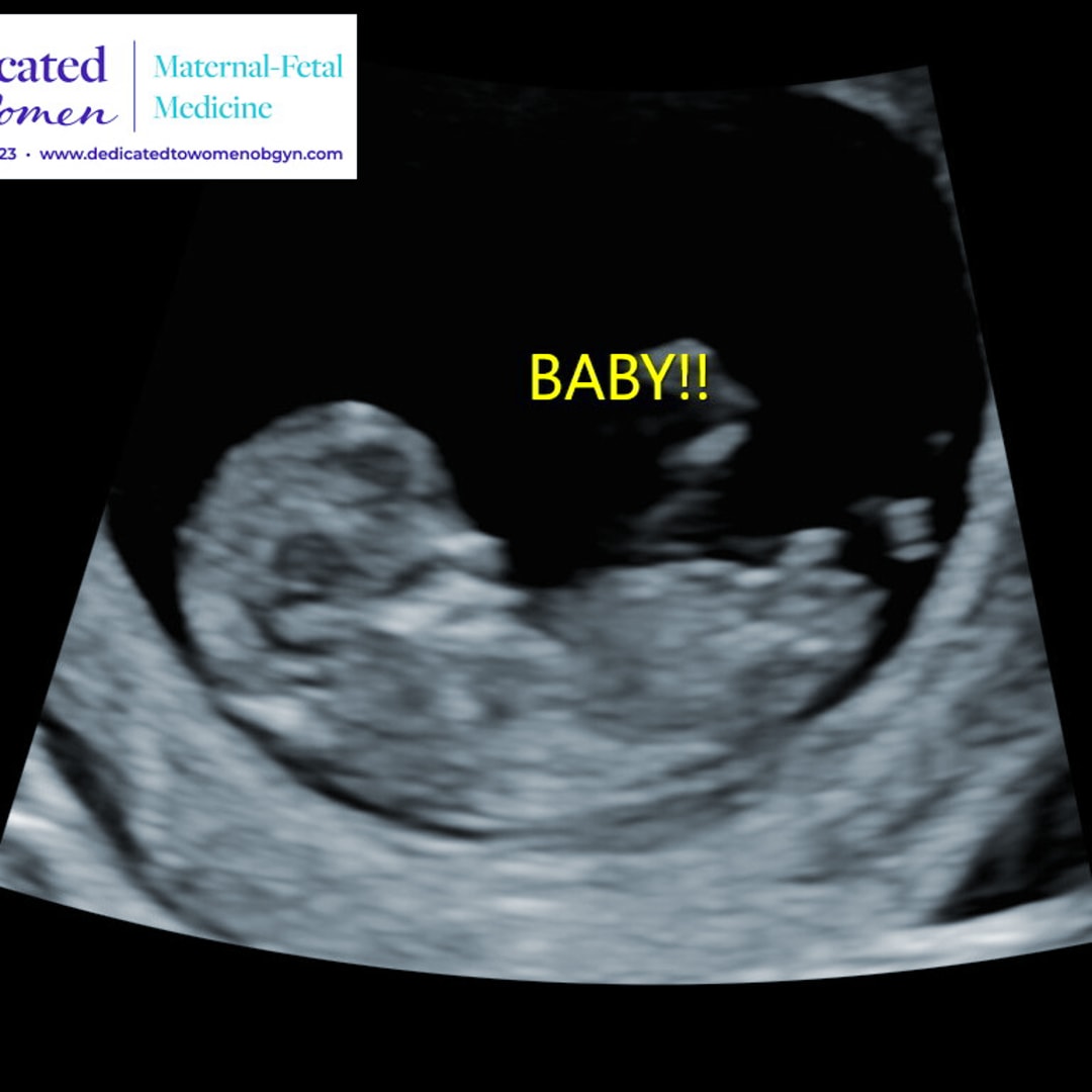 Photo shared by Peyton for their Babylist baby registry.